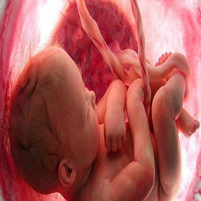 تعبیر خواب سقط جنین